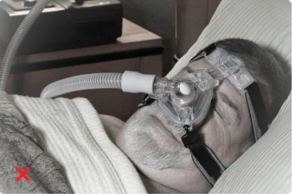 Sleep therapy comparison